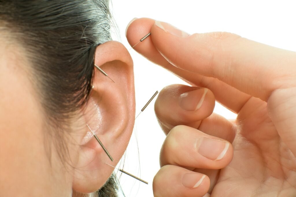 Woman - Ear - Ear Acupuncture