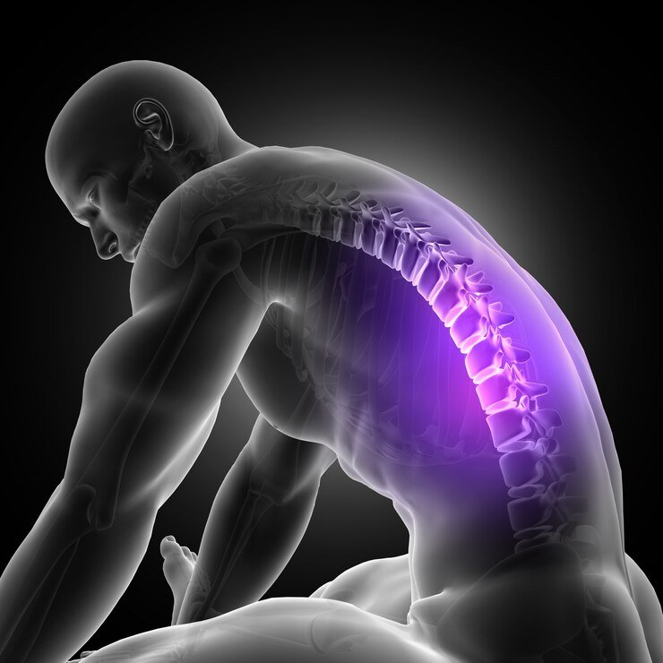 Back pain - Pain relief - Acupuncture